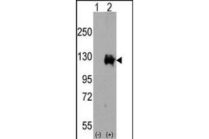 Western blot analysis of TR (arrow) using rabbit polyclonal TR Antibody (C-term) (ABIN392819 and ABIN2842251). (TRPM8 抗体  (C-Term))