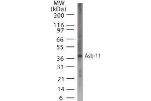 Image no. 1 for anti-Ankyrin Repeat and SOCS Box-Containing 11 (ASB11) (AA 40-51) antibody (ABIN233024) (ASB11 抗体  (AA 40-51))