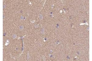 Immunohistochemistry analysis of CD57 antibody in paraffin-embedded human brain tissue. (CD57 抗体  (N-Term))