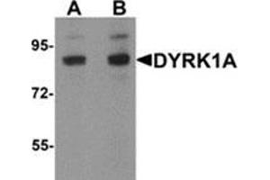 Western blot analysis of DYRK1A in HeLa cell lysate with DYRK1A antibody at (A) 1 and (B) 2 μg/ml. (DYRK1A 抗体  (C-Term))