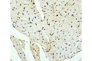 IHC analysis of PTBP2 using anti-PTBP2 antibody (ABIN7599452). (PTBP2 抗体  (AA 1-504))