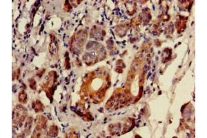 Immunohistochemistry of paraffin-embedded human salivary gland tissue using ABIN7152346 at dilution of 1:100 (SULF2 抗体  (AA 463-660))