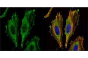 ICC/IF Image Aspartoacylase antibody [N1C3-2] detects Aspartoacylase protein at cytoplasm by immunofluorescent analysis. (ASPA 抗体)