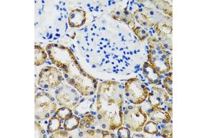 Immunohistochemistry of paraffin-embedded mouse kidney using COMT antibody (ABIN5973647) at dilution of 1/100 (40x lens). (COMT 抗体)