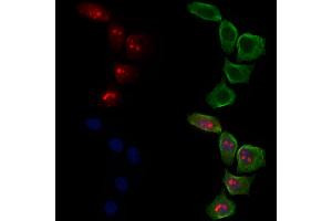 ABIN6263619 and ABIN6278595 staining Hela cells by IF/ICC. (Neurofibromin 1 抗体  (C-Term))
