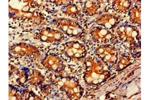 Immunohistochemistry of paraffin-embedded human small intestine tissue using ABIN7143442 at dilution of 1:100