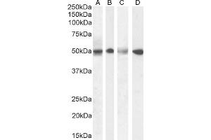 Western Blotting (WB) image for anti-Septin 6 (SEPT6) (Internal Region) antibody (ABIN570940)