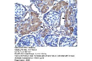 Rabbit Anti-PAX7 Antibody  Paraffin Embedded Tissue: Human Kidney Cellular Data: Epithelial cells of renal tubule Antibody Concentration: 4. (PAX7 抗体  (N-Term))