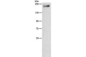 Western Blot analysis of Mouse lung tissue using IQGAP3 Polyclonal Antibody at dilution of 1:850 (IQGAP3 抗体)