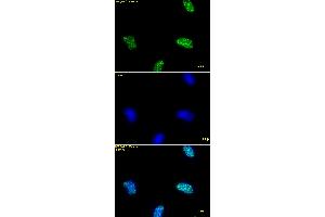 Immunofluorescence stain of Histone H3K9ac antibody (pAb). (Histone 3 抗体  (acLys9))