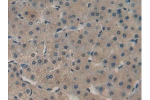 Detection of PKCe in Human Liver Tissue using Polyclonal Antibody to Protein Kinase C Epsilon (PKCe) (PKC epsilon 抗体  (AA 403-672))