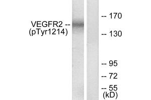 Western blot analysis of extracts from HepG2 cells, treated with Na3VO4 (0. (VEGFR2/CD309 抗体  (pTyr1214))