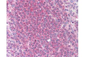 Anti-MCL1 antibody IHC of human spleen. (MCL-1 抗体)