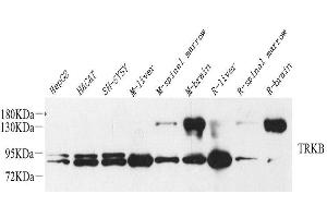 Western Blot analysis of various samples using NTRK2 Polyclonal Antibody at dilution of 1:1000. (TRKB 抗体)