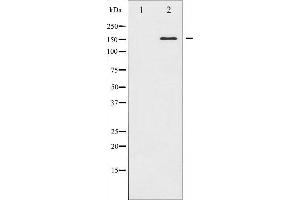 Western blot analysis of ASK1 expression in MDA-MB-435 whole cell lysates,The lane on the left is treated with the antigen-specific peptide. (ASK1 抗体  (N-Term))