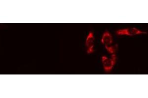 ABIN6275097 staining HeLa cells by IF/ICC. (RNF144B 抗体  (Internal Region))