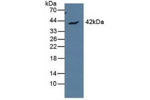 Detection of APOL1 in Human MCF7 Cells using Polyclonal Antibody to Apolipoprotein L (APOL1) (APOL1 抗体  (AA 1-238))
