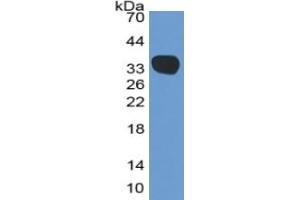 WB of Protein Standard: different control antibodies against Highly purified E. (Complement C4 ELISA 试剂盒)