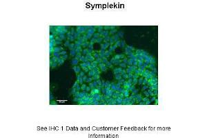 Sample Type :  Human HT29 cells  Primary Antibody Dilution :  1:50  Secondary Antibody :  Donkey anti Rabbit-Alexa Fluor 488  Secondary Antibody Dilution :  1:500  Color/Signal Descriptions :  Green: Symplekin Blue: DAPI  Gene Name :  SYMPK  Submitted by :  Louise Lagerqvist (PhD), Oncology Department, Institute of Functional Genomics, Montpellier, France. (Symplekin 抗体  (N-Term))