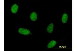 Immunofluorescence of purified MaxPab antibody to HNRPK on HeLa cell. (HNRNPK 抗体  (AA 1-463))
