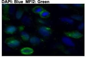 Immunofluorescent staining of HeLa cells with MFI2 polyclonal antibody  at 1:50 dilution. (MFI2 抗体  (C-Term))