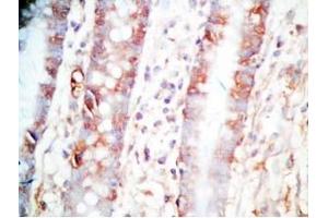 Human colon tissue was stained by Rabbit Anti-CCK (26-33)  (Human,Rat) Antibody (Cholecystokinin 抗体  (non-sulfated))