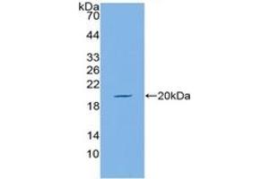 WB of Protein Standard: different control antibodies against Highly purified E. (MUC5AC ELISA 试剂盒)