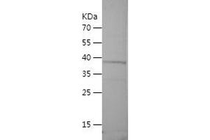 FCN3 Protein (AA 21-185) (His-IF2DI Tag)