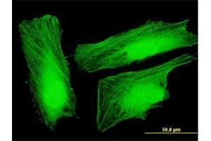 Immunofluorescence of purified MaxPab antibody to UXT on HeLa cell. (UXT 抗体  (AA 1-169))