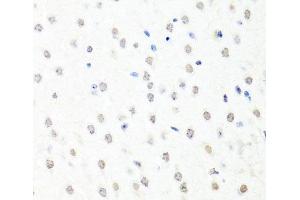 Immunohistochemistry of paraffin-embedded Mouse brain using CHRAC1 Polyclonal Antibody at dilution of 1:100 (40x lens). (CHRAC1 抗体)