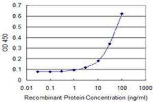 Image no. 4 for anti-Aldehyde Dehydrogenase 4 Family, Member A1 (ALDH4A1) (AA 1-564) antibody (ABIN599053) (ALDH4A1 抗体  (AA 1-564))