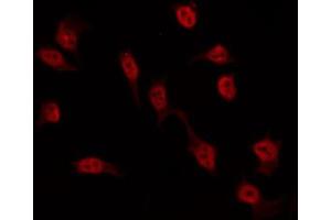 ABIN6274552 staining Hela by IF/ICC. (ASF1A 抗体  (Internal Region))