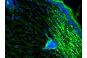 C57BL/6 mice were shaved, treated with nair to remove residual hair and painted with IFNg. (CXCL10 抗体  (AA 35-98))