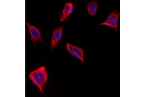 ABIN6262005 and ABIN6273249 staining Hela by IF/ICC. (GMFG 抗体  (Internal Region))