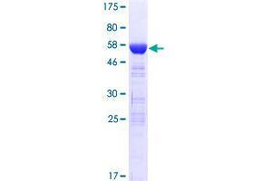 Image no. 1 for Deoxyhypusine Hydroxylase/monooxygenase (DOHH) (AA 1-302) protein (GST tag) (ABIN1351898) (DOHH Protein (AA 1-302) (GST tag))