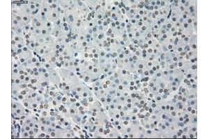 Immunohistochemistry (IHC) image for anti-Protein Phosphatase 5, Catalytic Subunit (PPP5C) antibody (ABIN2729511)