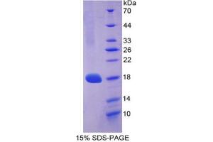 SDS-PAGE analysis of Mouse COL3A1 Protein. (COL3A1 蛋白)