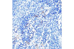 Immunohistochemistry of paraffin-embedded mouse spleen using CD11a/LFA-1A/ITGAL antibody (ABIN3015541, ABIN3015542, ABIN3015543, ABIN1680526 and ABIN6218728) at dilution of 1:100 (40x lens).
