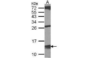 Western Blotting (WB) image for anti-Macrophage Migration Inhibitory Factor (Glycosylation-Inhibiting Factor) (MIF) antibody (ABIN2854957)