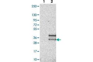 Western blot analysis of Lane 1: Negative control (vector only transfected HEK293T lysate). (CD99L2 抗体)