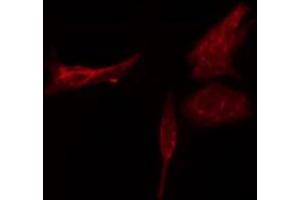 ABIN6274777 staining HT29 cells by IF/ICC. (RPL3 抗体  (C-Term))