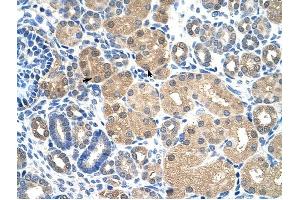 KEAP1 antibody was used for immunohistochemistry at a concentration of 4-8 ug/ml to stain Epithelial cells of renal tubule (arrows) in Human Kidney. (KEAP1 抗体  (C-Term))