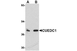 Western blot analysis of CUEDC1 in rat liver tissue lysate with AP30261PU-N CUEDC1 antibody at (A) 0. (CUEDC1 抗体  (C-Term))