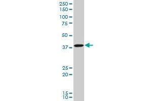 TFAP4 polyclonal antibody (A01), Lot # 051005JC01 Western Blot analysis of TFAP4 expression in Hela S3 NE . (TFAP4 抗体  (AA 93-192))