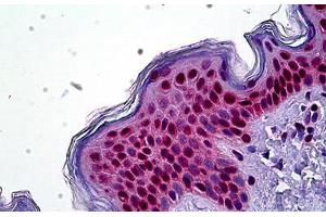 Human Skin: Formalin-Fixed, Paraffin-Embedded (FFPE) (SETD8 抗体  (N-Term))