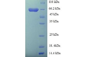 SDS-PAGE (SDS) image for GDP Dissociation Inhibitor 2 (GDI2) (AA 1-445), (full length) protein (His-SUMO Tag) (ABIN5709567)