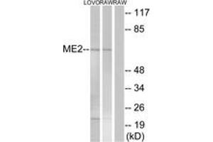 Western blot analysis of extracts from RAW264. (NAD-ME 抗体  (AA 201-250))