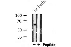 Western blot analysis of VGF  expression in Rat brain lysate