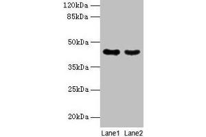 Western blot All lanes: MAS1L antibody at 2 μg/mL Lane 1: Colo320 whole cell lysate Lane 2: Hela whole cell lysate Secondary Goat polyclonal to rabbit IgG at 1/10000 dilution Predicted band size: 43 kDa Observed band size: 43 kDa (MAS1L 抗体  (AA 318-378))