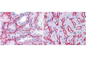 Anti collagen IV antibody (1:400, 45 min RT) showed strong staining in FFPE sections of human kidney (Left) with strong red staining observed in glomeruli and liver (Right) with strong staining in sinusoids. (Collagen IV 抗体  (Biotin))